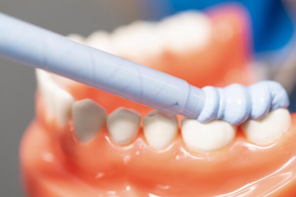 ثبت بایت – Vincismile PERFIT (Bite Registration) - تصویر 2