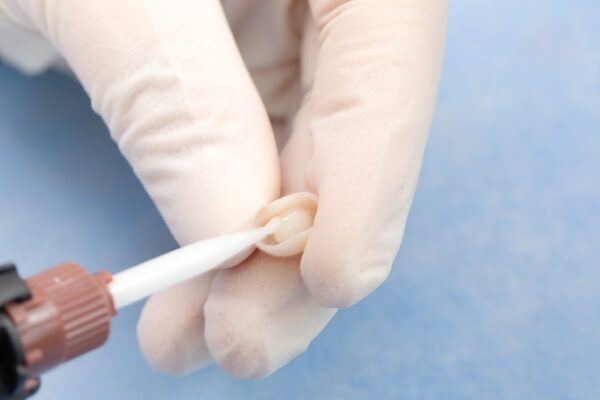 سمان رزینی دوال کیور Vincismile – TopCEM Dual Cure Resin Cement - تصویر 2
