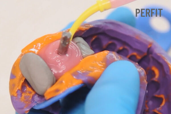 جینجیوال ماسک Vincismile PERFIT Gingiva Mask - تصویر 3