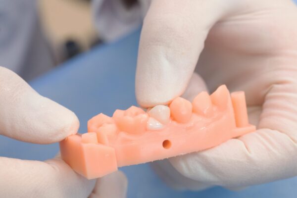 TopCEM Dual Cure Resin Cement - Image 3