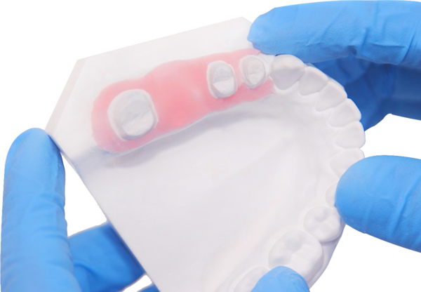 جینجیوال ماسک Vincismile PERFIT Gingiva Mask - تصویر 2
