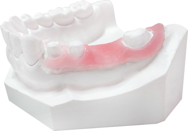 جینجیوال ماسک Vincismile PERFIT Gingiva Mask - تصویر 6